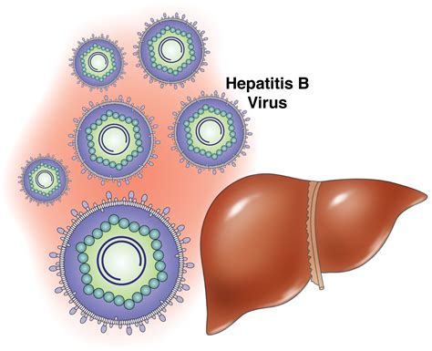 hbv|Hepatitis B .